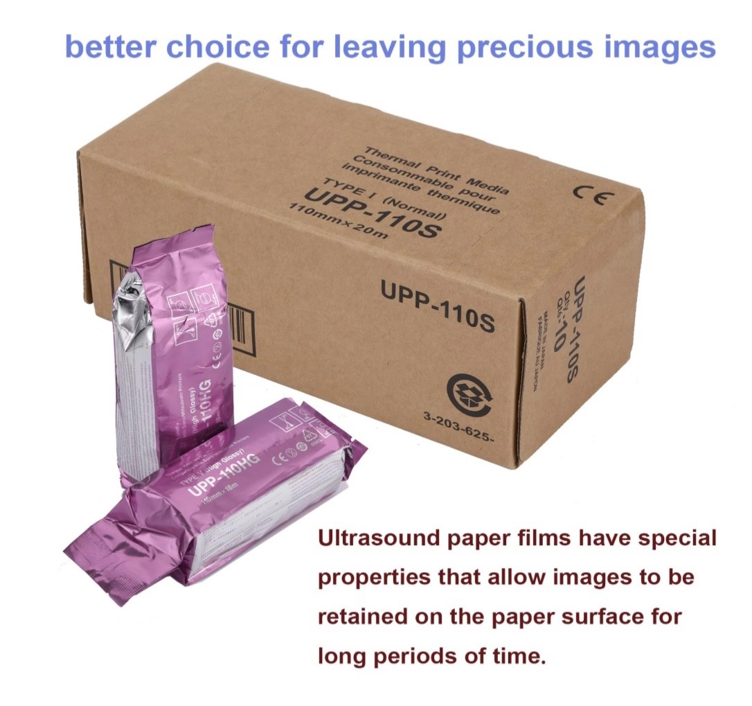5 Rolls UPP-110HG High Gloss Ultrasound Paper Type V, UPP-110HG Sony Compatible