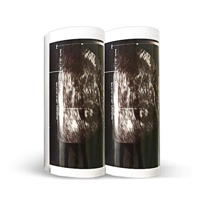 High Gloss Ultrasound Thermal Paper Rolls, 110mm x 18m, 10 Pack for Printers