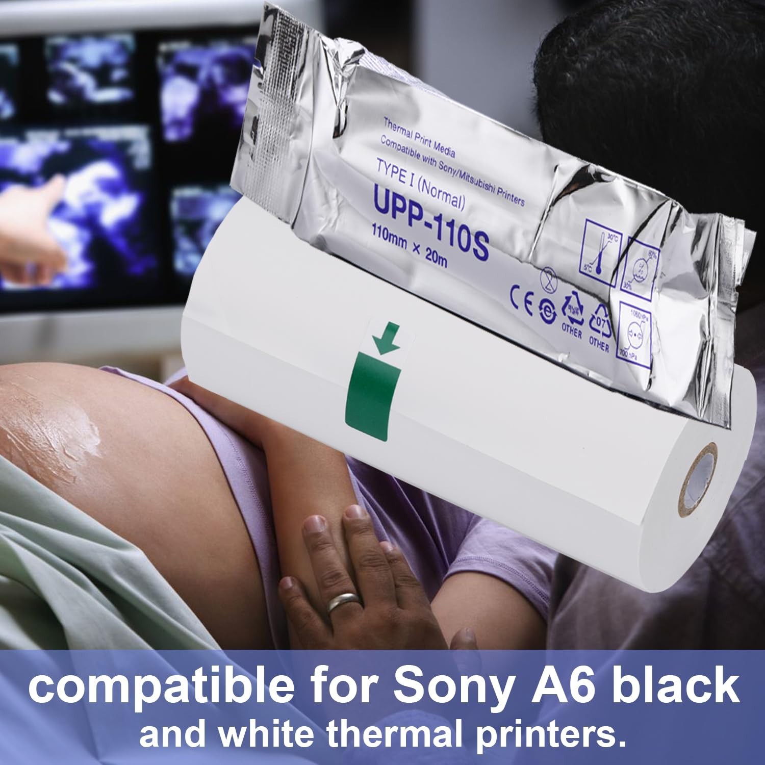 UPP-110S Ultrasound Paper – 5 Rolls, 110mm x 20m, Black & White Printing