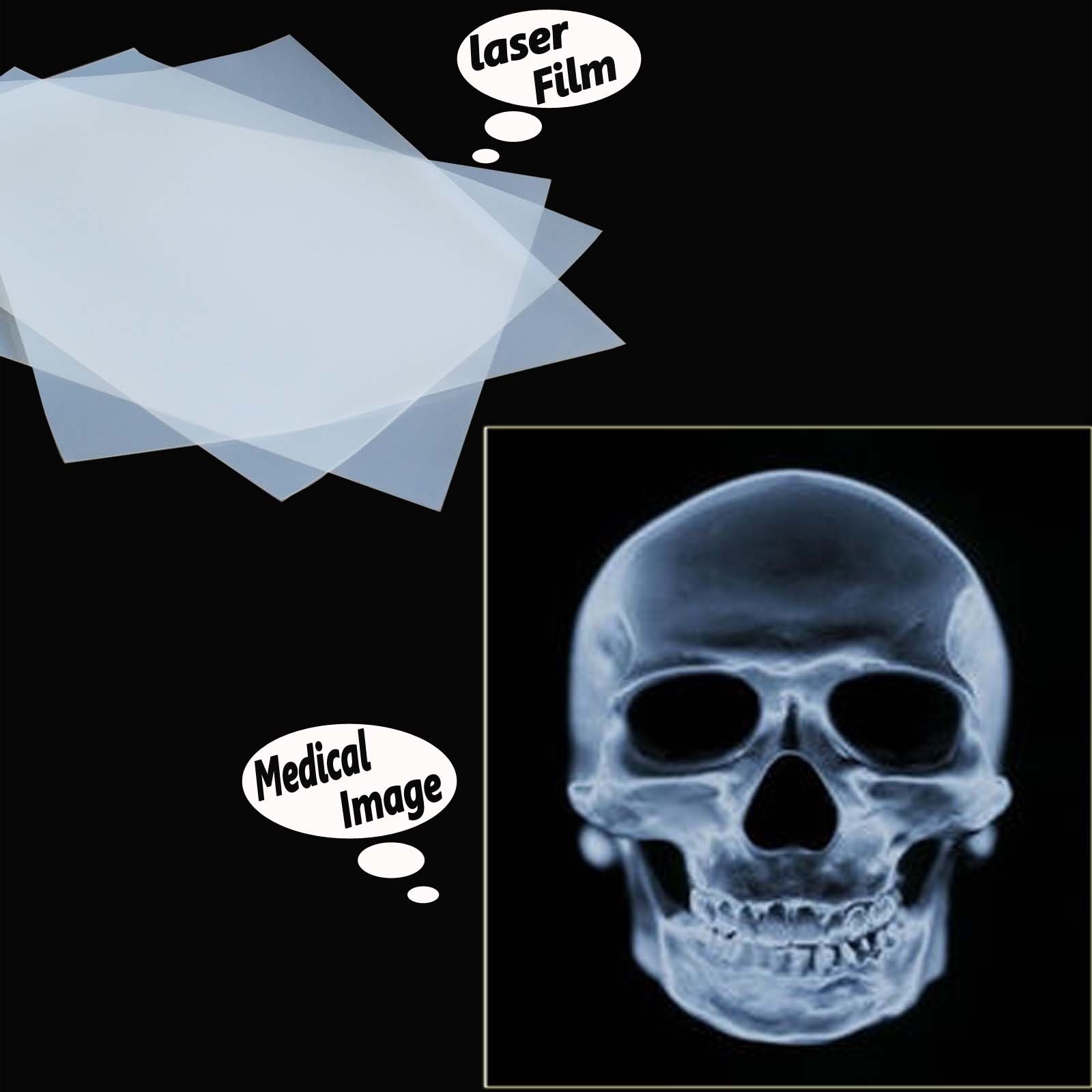 11″ x 17″，200 Sheets，Silk Screen Printing Milky Transparency Laser Printer Film