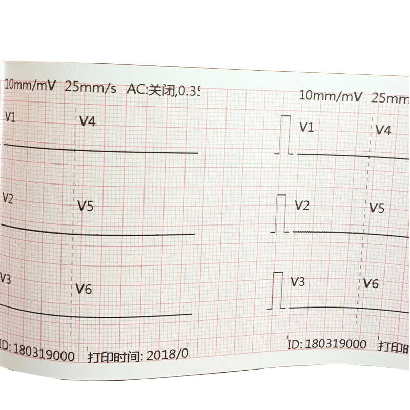 10 Roll 80mm*20m Thermal Printer paper for ECG/EKG Machine Electrocardiograph